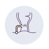 Fístula Anal