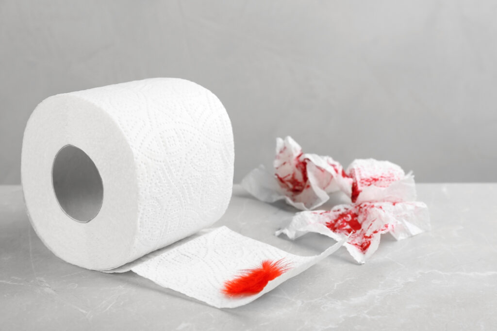 Sangramento anal: o que pode ser? É sempre grave? 1 roll of toilet paper and red feather on table hem 2026 01 11 11 09 09 utc