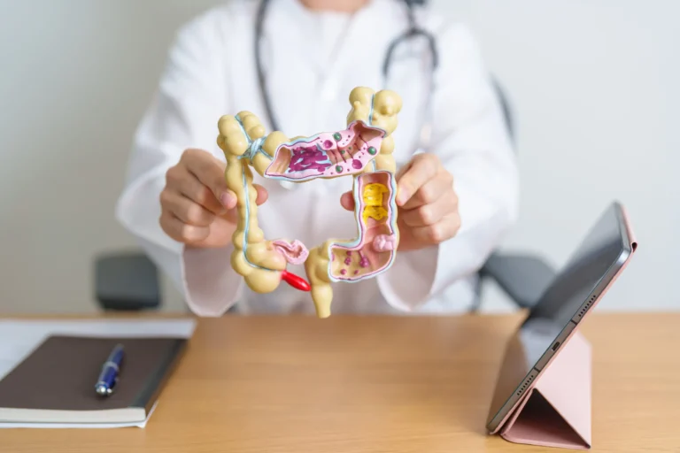 hemorroidas e câncer de intestino - Dr. Gilberto Saute responde